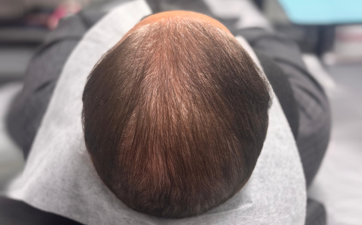 Before-الزراعة المطورة